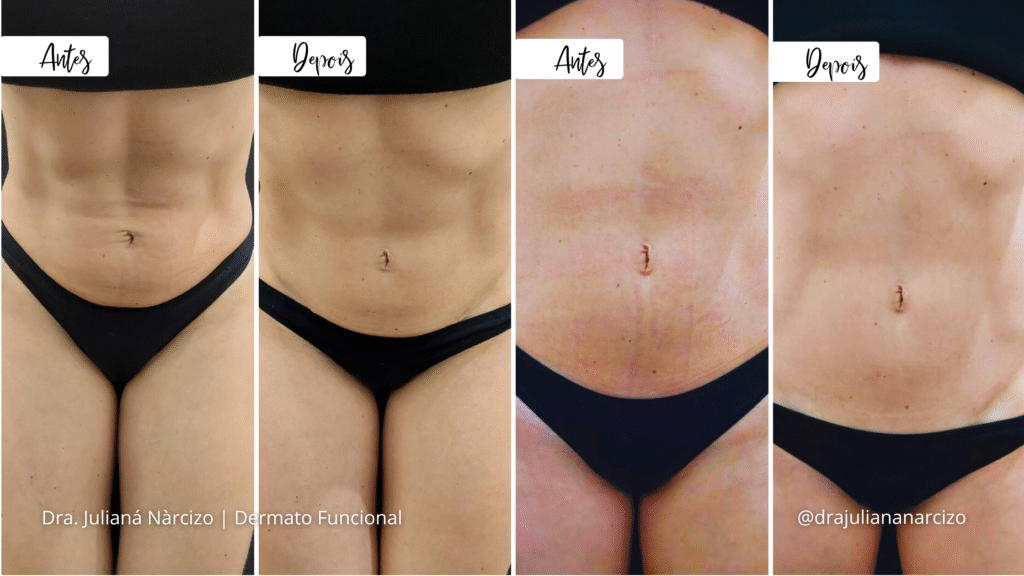 tratamentos estéticos