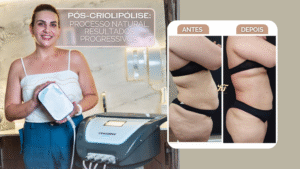 Harmonização Corporal e o Gerenciamento do Envelhecimento: O novo padrão de beleza e longevidade com a Tecnologia que mantém a pele jovem